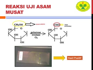 REAKSI UJI ASAM
MUSAT
Hasil Positif
 