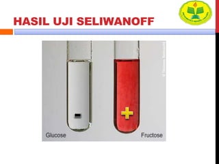 HASIL UJI SELIWANOFF
 