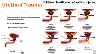 ppt urethra scrotum radiological findings.pptx