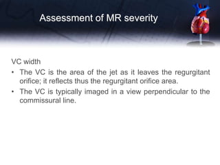 VC width
• The VC is the area of the jet as it leaves the regurgitant
orifice; it reflects thus the regurgitant orifice area.
• The VC is typically imaged in a view perpendicular to the
commissural line.
Assessment of MR severity
 