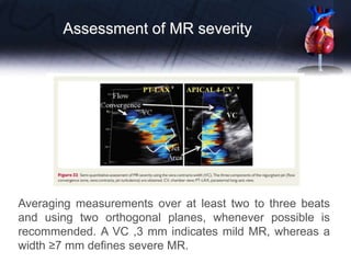 Averaging measurements over at least two to three beats
and using two orthogonal planes, whenever possible is
recommended. A VC ,3 mm indicates mild MR, whereas a
width ≥7 mm defines severe MR.
Assessment of MR severity
 