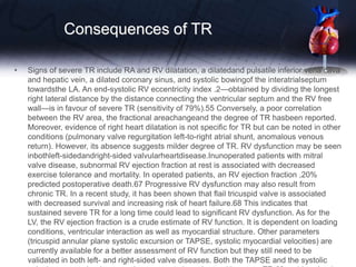 Consequences of TR
• Signs of severe TR include RA and RV dilatation, a dilatedand pulsatile inferior vena cava
and hepatic vein, a dilated coronary sinus, and systolic bowingof the interatrialseptum
towardsthe LA. An end-systolic RV eccentricity index .2—obtained by dividing the longest
right lateral distance by the distance connecting the ventricular septum and the RV free
wall—is in favour of severe TR (sensitivity of 79%).55 Conversely, a poor correlation
between the RV area, the fractional areachangeand the degree of TR hasbeen reported.
Moreover, evidence of right heart dilatation is not specific for TR but can be noted in other
conditions (pulmonary valve regurgitation left-to-right atrial shunt, anomalous venous
return). However, its absence suggests milder degree of TR. RV dysfunction may be seen
inbothleft-sidedandright-sided valvularheartdisease.Inunoperated patients with mitral
valve disease, subnormal RV ejection fraction at rest is associated with decreased
exercise tolerance and mortality. In operated patients, an RV ejection fraction ,20%
predicted postoperative death.67 Progressive RV dysfunction may also result from
chronic TR. In a recent study, it has been shown that flail tricuspid valve is associated
with decreased survival and increasing risk of heart failure.68 This indicates that
sustained severe TR for a long time could lead to significant RV dysfunction. As for the
LV, the RV ejection fraction is a crude estimate of RV function. It is dependent on loading
conditions, ventricular interaction as well as myocardial structure. Other parameters
(tricuspid annular plane systolic excursion or TAPSE, systolic myocardial velocities) are
currently available for a better assessment of RV function but they still need to be
validated in both left- and right-sided valve diseases. Both the TAPSE and the systolic
 
