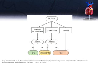 Augustine, Daniel X., et al. "Echocardiographic assessment of pulmonary hypertension: a guideline protocol from the British Society of
Echocardiography." Echo Research & Practice 5.3 (2018): G11-G24.
 