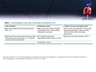 Augustine, Daniel X., et al. "Echocardiographic assessment of pulmonary hypertension: a guideline protocol from the British Society of
Echocardiography." Echo Research & Practice 5.3 (2018): G11-G24.
 