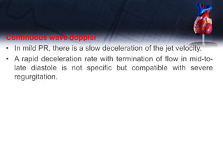 Continuous wave doppler
• In mild PR, there is a slow deceleration of the jet velocity.
• A rapid deceleration rate with termination of flow in mid-to-
late diastole is not specific but compatible with severe
regurgitation.
 