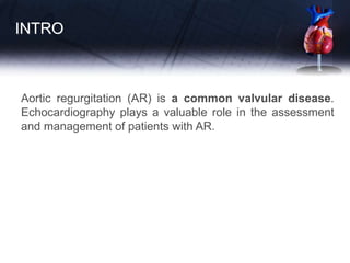 INTRO
Aortic regurgitation (AR) is a common valvular disease.
Echocardiography plays a valuable role in the assessment
and management of patients with AR.
 
