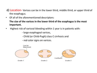 d) Location- Varices can be in the lower third, middle third, or upper third of
the esophagus.
• Of all of the aforementioned descriptors:
The size of the varices in the lower third of the esophagus is the most
important.
• Highest risk of variceal bleeding within 1 year is in patients with:
- large esophageal varices,
- Child (or Child-Pugh) class C cirrhosis and
- red color signs on varices.
 