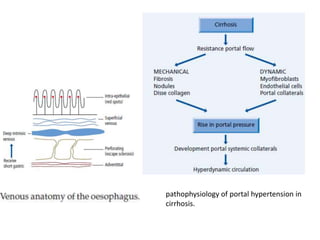 pathophysiology of portal hypertension in
cirrhosis.
 