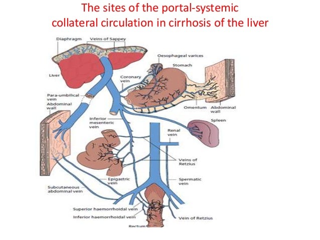 Ppt variceal bleed by dr. juned