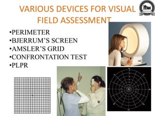 VARIOUS DEVICES FOR VISUAL
FIELD ASSESSMENT…
•PERIMETER
•BJERRUM’S SCREEN
•AMSLER’S GRID
•CONFRONTATION TEST
•PLPR
 