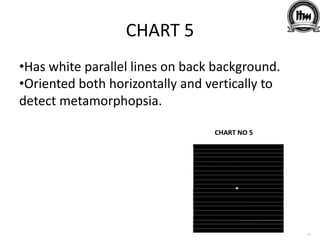 CHART 5
•Has white parallel lines on back background.
•Oriented both horizontally and vertically to
detect metamorphopsia.
 