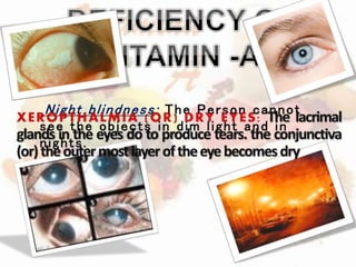 Night bl indness: The Person cannot 
see the objects in dim l ight and in 
nights. 
 