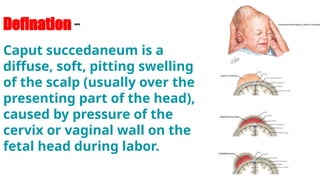 Disease of foetus (slides share presentation by Akash sen ) | PPTX