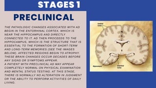 THE PATHOLOGIC CHANGES ASSOCIATED WITH AD
BEGIN IN THE ENTORHINAL CORTEX, WHICH IS
NEAR THE HIPPOCAMPUS AND DIRECTLY
CONNECTED TO IT. AD THEN PROCEEDS TO THE
HIPPOCAMPUS, WHICH IS THE STRUCTURE THAT IS
ESSENTIAL TO THE FORMATION OF SHORT-TERM
AND LONG-TERM MEMORIES (SEE THE IMAGES
BELOW). AFFECTED REGIONS BEGIN TO ATROPHY.
THESE BRAIN CHANGES OCCUR DECADES BEFORE
ANY SIGNS OR SYMPTOMS APPEAR.
A PATIENT WITH PRECLINICAL AD MAY APPEAR
COMPLETELY NORMAL ON PHYSICAL EXAMINATION
AND MENTAL STATUS TESTING. AT THIS STAGE,
THERE IS NORMALLY NO ALTERATION IN JUDGMENT
OR THE ABILITY TO PERFORM ACTIVITIES OF DAILY
LIVING.
PRECLINICAL
STAGES 1
 