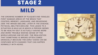 THE GROWING NUMBER OF PLAQUES AND TANGLES
FIRST DAMAGE AREAS OF THE BRAIN THAT
CONTROL MEMORY, LANGUAGE, AND REASONING
(SEE THE IMAGES BELOW). LATER IN THE DISEASE,
PHYSICAL ABILITIES DECLINE. THIS LEADS TO A
SITUATION IN MILD AD IN WHICH A PERSON SEEMS
TO BE HEALTHY BUT IS ACTUALLY HAVING MORE
AND MORE TROUBLE MAKING SENSE OF THE
WORLD AROUND HIM OR HER. THE REALIZATION
THAT SOMETHING IS WRONG OFTEN COMES
GRADUALLY BECAUSE THE EARLY SIGNS CAN BE
CONFUSED WITH CHANGES THAT CAN HAPPEN
NORMALLY WITH AGING.
MILD
STAGE 2
 