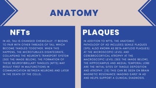 ANATOMY
PLAQUES
NFTs
 