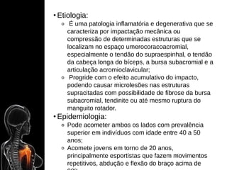 • Etiologia:
⚬ É uma patologia inflamatória e degenerativa que se
caracteriza por impactação mecânica ou
compressão de determinadas estruturas que se
localizam no espaço umerocoracoacromial,
especialmente o tendão do supraespinhal, o tendão
da cabeça longa do bíceps, a bursa subacromial e a
articulação acromioclavicular;
⚬ Progride com o efeito acumulativo do impacto,
podendo causar microlesões nas estruturas
supracitadas com possibilidade de fibrose da bursa
subacromial, tendinite ou até mesmo ruptura do
manguito rotador.
• Epidemiologia:
⚬ Pode acometer ambos os lados com prevalência
superior em indivíduos com idade entre 40 a 50
anos;
⚬ Acomete jovens em torno de 20 anos,
principalmente esportistas que fazem movimentos
repetitivos, abdução e flexão do braço acima de
 