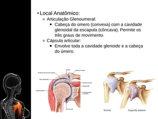 • Local Anatômico:
⚬ Articulação Glenoumeral:
￭ Cabeça do úmero (convexa) com a cavidade
glenoidal da escapula (côncava). Permite os
três graus de movimento.
⚬ Cápsula articular:
￭ Envolve toda a cavidade glenoide e a cabeça
do úmero.
 