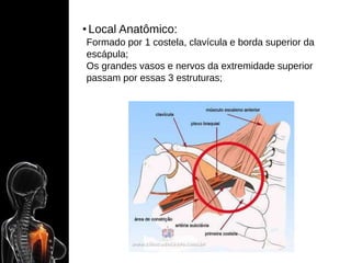 • Local Anatômico:
Formado por 1 costela, clavícula e borda superior da
escápula;
Os grandes vasos e nervos da extremidade superior
passam por essas 3 estruturas;
 