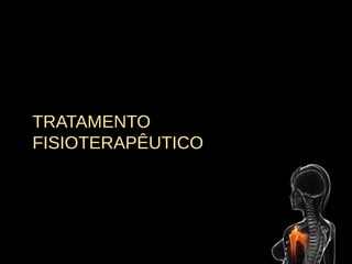 TRATAMENTO
FISIOTERAPÊUTICO
 