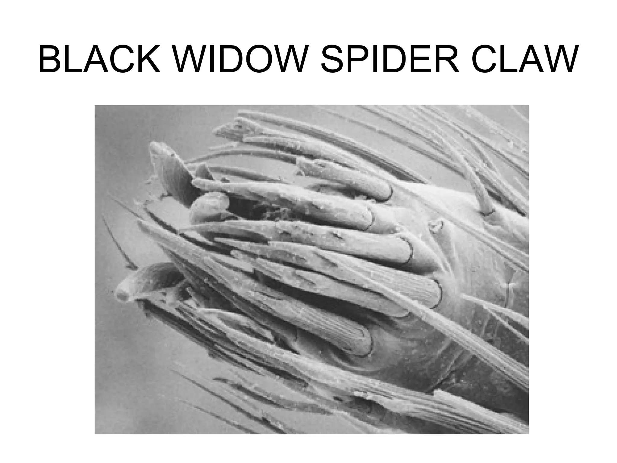 BLACK WIDOW SPIDER CLAW
 