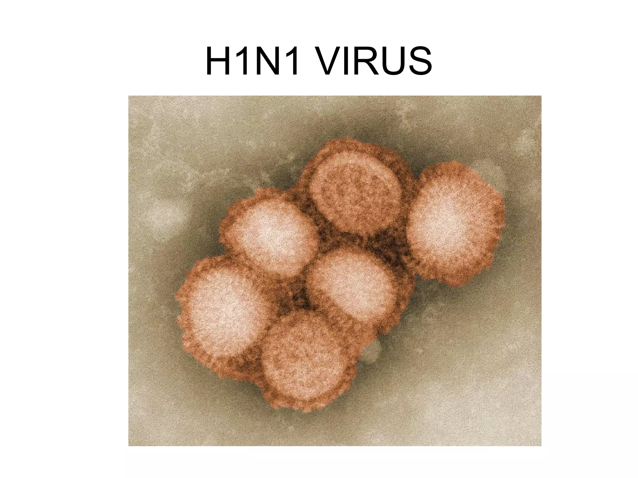H1N1 VIRUS
 