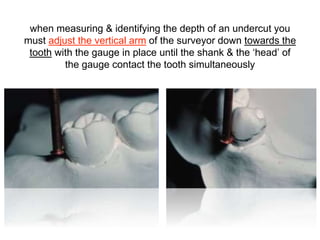 PPT Yr 2 Dental surveyor & surveying.pptx