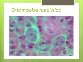 Entamoeba histolytica
 