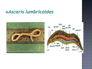 Ascaris   lumbricoides
 
