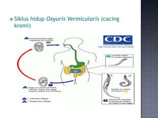  Siklus
       hidup Oxyuris Vermicularis (cacing
 kremi)
 