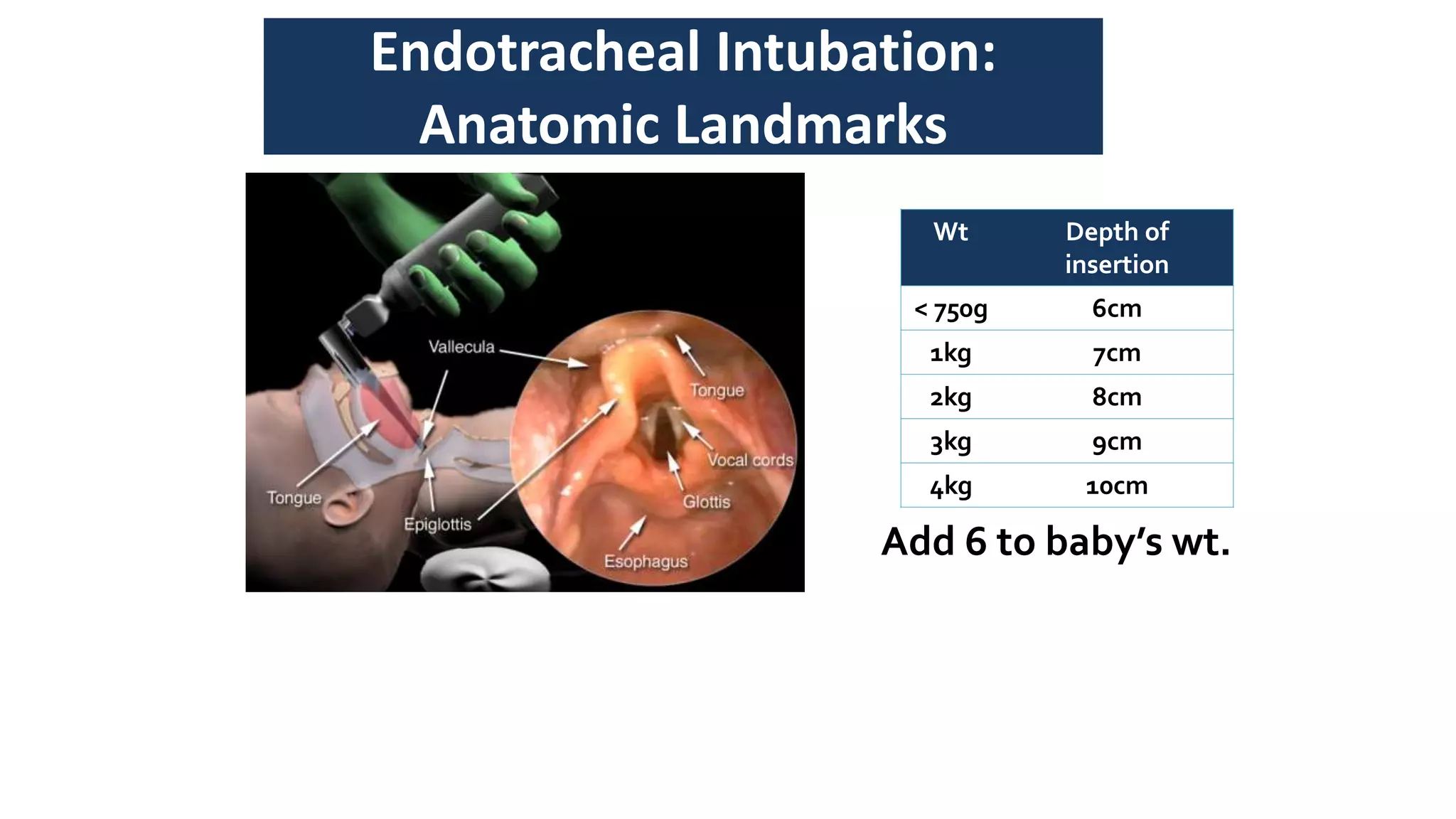 positive pressure ventilation in NRP PPT