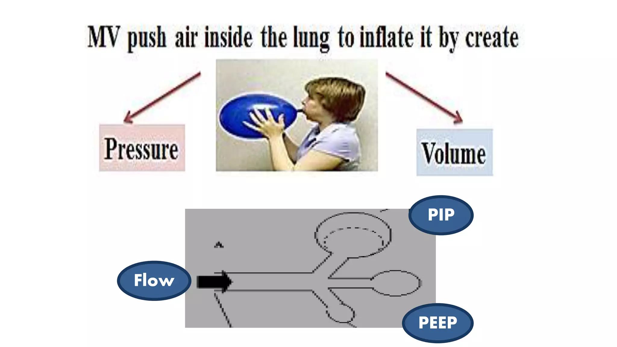 positive pressure ventilation in NRP PPT
