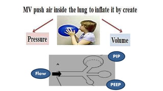 positive pressure ventilation in NRP | PPT