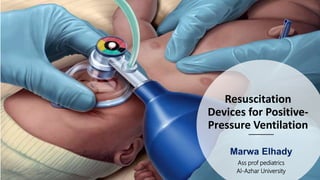 Resuscitation
Devices for Positive-
Pressure Ventilation
Marwa Elhady
Ass prof pediatrics
Al-Azhar University
 