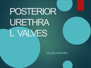 POSTERIOR
URETHRA
L VALVES
DR.LEELAKRISHNA
 