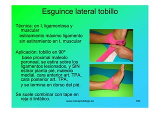www.menapodologo.es 100
Esguince lateral tobillo
Técnica: en I, ligamentosa y
muscular
estiramiento máximo ligamento
sin estiramiento en t. muscular
Aplicación: tobillo en 90º
base proximal maleolo
peroneal, se estira sobre los
ligamentos lesionados, y SIN
estirar planta pié, maleolo
medial, cara anterior art. TPA,
cara posterior art. TPA,
y se termina en dorso del pié.
Se suele combinar con tape en
reja ó linfático.
 