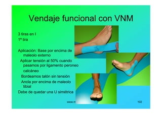 www.menapodologo.es 102
Vendaje funcional con VNM
3 tiras en I
1ª tira
Aplicación: Base por encima de
maleolo externo
Aplicar tensión al 50% cuando
pasamos por ligamento peroneo
calcáneo
Bordeamos talón sin tensión
Ancla por encima de maleolo
tibial
Debe de quedar una U simétrica
 