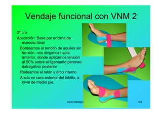 www.menapodologo.es 103
Vendaje funcional con VNM 2
2ª tira
Aplicación: Base por encima de
maleolo tibial
Bordeamos el tendón de aquiles sin
tensión, nos dirigimos hacia
anterior, donde aplicamos tensión
al 50% sobre el ligamento peroneo
astragalino posterior
Rodeamos el talón y arco interno
Ancla en cara anterior del tobillo, a
nivel de medio pie.
 