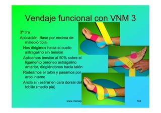 www.menapodologo.es 104
Vendaje funcional con VNM 3
3ª tira
Aplicación: Base por encima de
maleolo tibial
Nos dirigimos hacia el cuello
astragalino sin tensión
Aplicamos tensión al 50% sobre el
ligamento peroneo astragalino
anterior, dirigiéndonos hacia talón
Rodeamos el talón y pasamos por
arco interno
Ancla sin estirar en cara dorsal del
tobillo (medio pié)
 