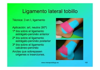www.menapodologo.es 105
Ligamento lateral tobillo
Técnica: 3 en I, ligamento
Aplicación: art. neutra (90º)
1ª tira sobre el ligamento
astrágalo-peronéo anterior
2ª tira sobre el ligamento
astrágalo-peronéo posterior
3ª tira sobre el ligamento
calcáneo-peronéo
Anclas que sobrepasen
origenes e inserciones.
 