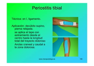 www.menapodologo.es 106
Periostitis tibial
Técnica: en I, ligamento.
Aplicación: decúbito supino,
pierna relajada.
se aplica el tape con
estiramiento desde el
centro hasta la longitud
total del trayecto doloroso
Anclas craneal y caudal a
la zona dolorosa.
 