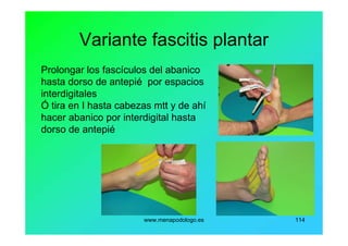 www.menapodologo.es 114
Variante fascitis plantar
Prolongar los fascículos del abanico
hasta dorso de antepié por espacios
interdigitales
Ó tira en I hasta cabezas mtt y de ahí
hacer abanico por interdigital hasta
dorso de antepié
 
