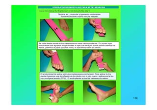 www.menapodologo.es 116
Autores: Calvo Galiana, M.I., Mena Sánchez, F.J., Valle Verdura D., Sáez Istilar E.
Se mide desde dorsal de los metatarsianos hasta calcáneo plantar. En primer lugar
practicamos dos agujeros longitudinales al tape que será por donde introduciremos los
dedos, partimos el papel por este nivel y lo aplicamos sobre los dedos.
El ancla dorsal de aplica sobre los metatarsianos sin tensión. Para aplicar la tira
plantar hacemos una dorsiflexión de los dedos con la otra mano y aplicamos la tira
con una ligera tensión (25%). El ancla plantar a nivel de calcáneo sin estirar.
Técnica: en I, muscular y ligamento combinadas.
Paciente decúbito supino con pie relajado.
VENDAJE NEUROMUSCULAR PARA METATARSALGIA
 