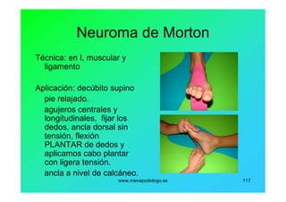 www.menapodologo.es 117
Neuroma de Morton
Técnica: en I, muscular y
ligamento
Aplicación: decúbito supino
pie relajado.
agujeros centrales y
longitudinales, fijar los
dedos, ancla dorsal sin
tensión, flexión
PLANTAR de dedos y
aplicamos cabo plantar
con ligera tensión.
ancla a nivel de calcáneo.
 