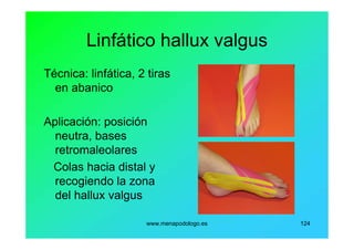 www.menapodologo.es 124
Linfático hallux valgus
Técnica: linfática, 2 tiras
en abanico
Aplicación: posición
neutra, bases
retromaleolares
Colas hacia distal y
recogiendo la zona
del hallux valgus
 