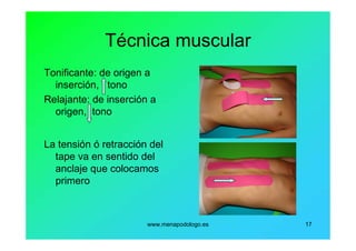 www.menapodologo.es 17
Técnica muscular
Tonificante: de origen a
inserción, tono
Relajante: de inserción a
origen, tono
La tensión ó retracción del
tape va en sentido del
anclaje que colocamos
primero
 