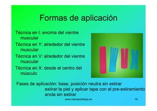 www.menapodologo.es 19
Formas de aplicación
Técnica en I: encima del vientre
muscular
Técnica en Y: alrededor del vientre
muscular
Técnica en V: alrededor del vientre
muscular
Técnica en X: desde el centro del
músculo
Fases de aplicación: base, posición neutra sin estirar
estirar la piel y aplicar tape con el pre-estiramiento
ancla sin estirar
 