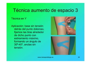 www.menapodologo.es 24
Técnica aumento de espacio 3
Técnica en Y
Aplicación: base sin tensión
detrás del punto doloroso,
fijamos las tiras alrededor
de dicho punto con
estiramiento máximo,
formando un ángulo de
30º-40º, anclas sin
tensión.
 