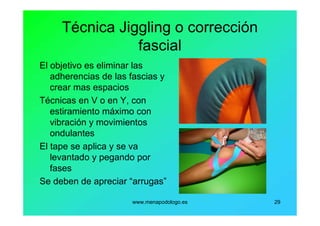 www.menapodologo.es 29
Técnica Jiggling o corrección
fascial
El objetivo es eliminar las
adherencias de las fascias y
crear mas espacios
Técnicas en V o en Y, con
estiramiento máximo con
vibración y movimientos
ondulantes
El tape se aplica y se va
levantado y pegando por
fases
Se deben de apreciar “arrugas”
 