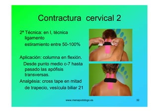 www.menapodologo.es 32
Contractura cervical 2
2ª Técnica: en I, técnica
ligamento
estiramiento entre 50-100%
Aplicación: columna en flexión.
Desde punto medio c-7 hasta
pasado las apófisis
transversas.
Analgésia: cross tape en mitad
de trapecio, vesícula biliar 21
 